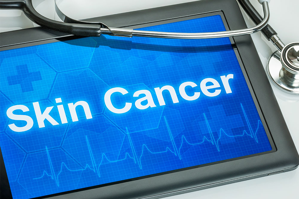 Skin cancer – Types and warning signs